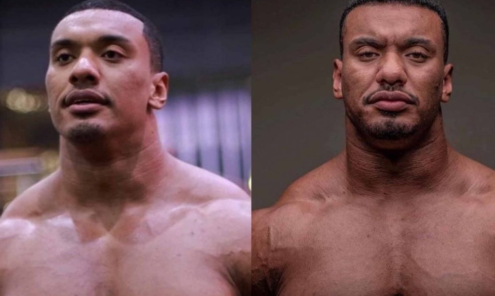 Mudança facial, mostrando envelhecimento precoce, do influenciar e atleta Larry Wheels antes e depois de anos usando esteroides anabolizantes. Antes de considerar envelhecimento natural, considere que ele tinha 27 anos na foto da direta. Larry nasceu em 1994 e na data desta postagem, tem 31 anos.