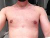 04---22-dias-pos-cirurgia-(ontem).jpg