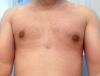 03---13-dias-pos-cirurgia.jpg