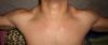 post-72371-0-10858000-1340505827_thumb.j