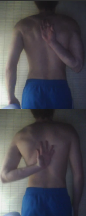 ombro.png