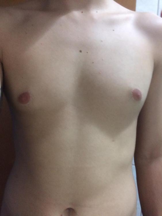mamilo2.jpg