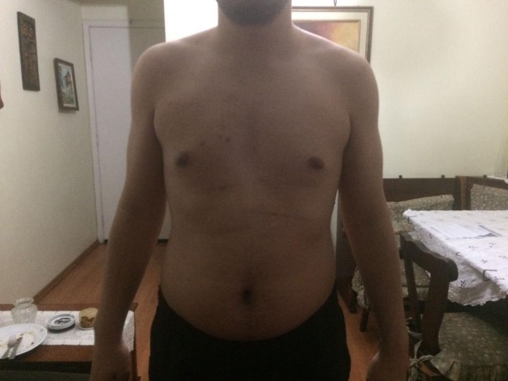 595aeeec37568_MUSCULAO2.thumb.jpg.f6f5ac50efd578265070235fb44ba679.jpg